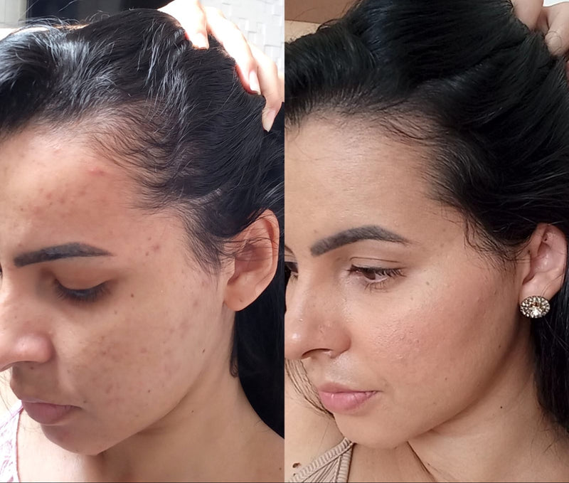 Cabelo e Stress: Como a Saúde Mental Afeta Seus Fios