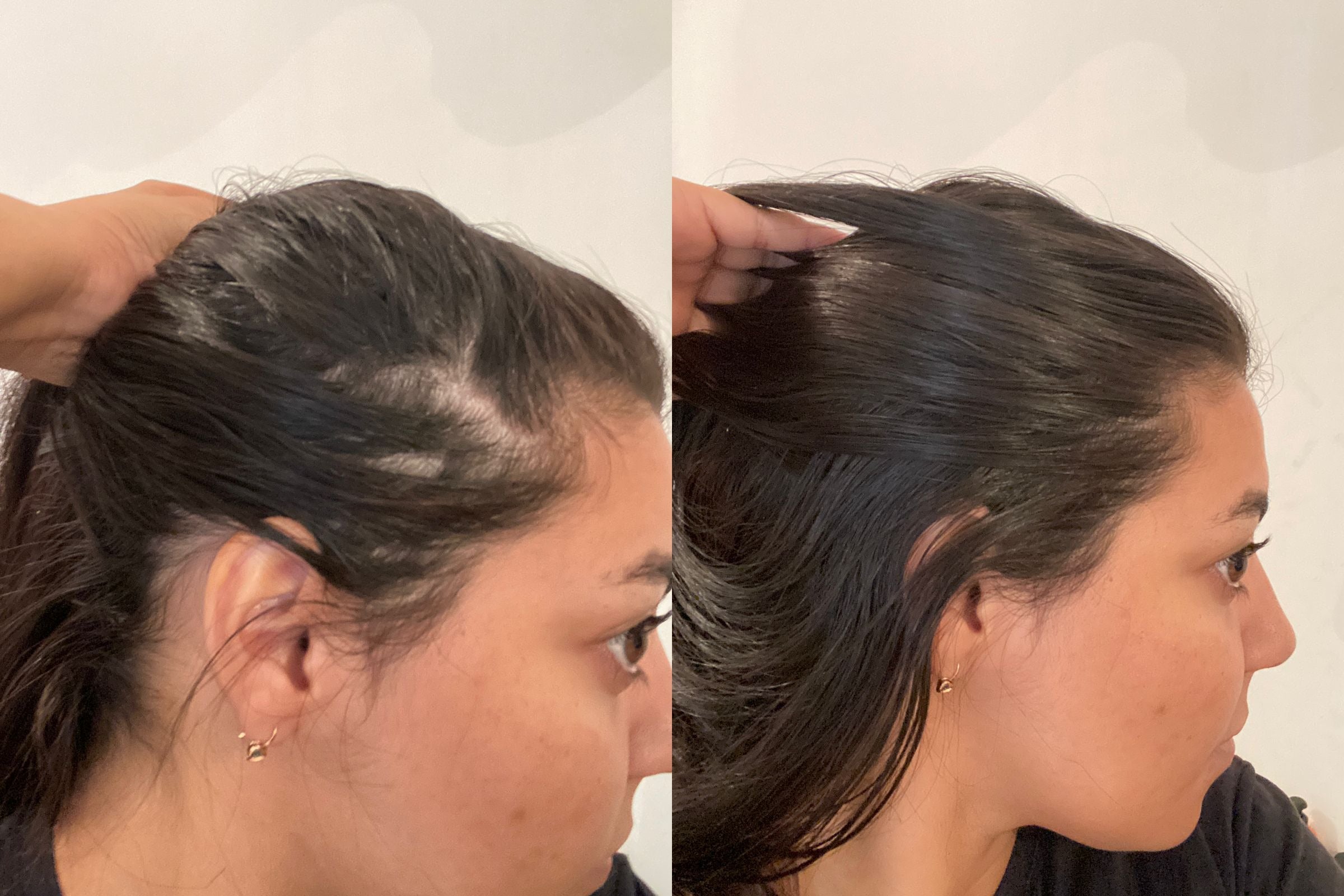 Scalp Saudável: A Base para Cabelos Bonitos e Fortes