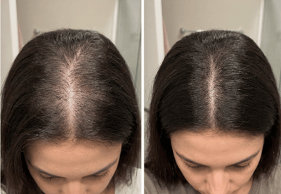 Transformação com Soliv