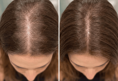 Transformação com Soliv