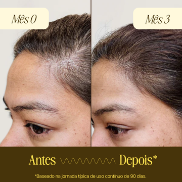 Sérum Capilar Soliv