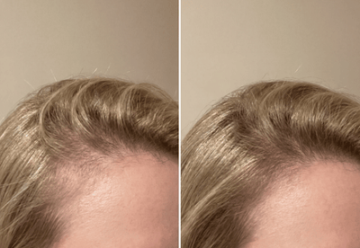 Transformação com Soliv