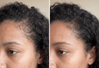 Transformação com Soliv