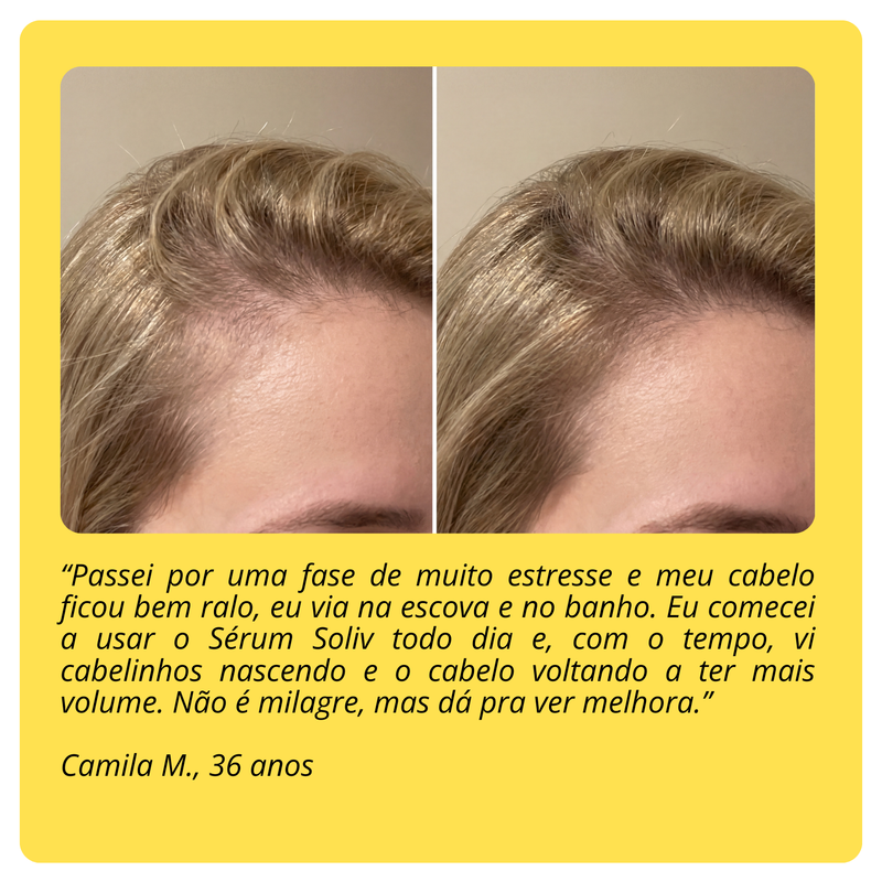 Sérum Capilar Soliv